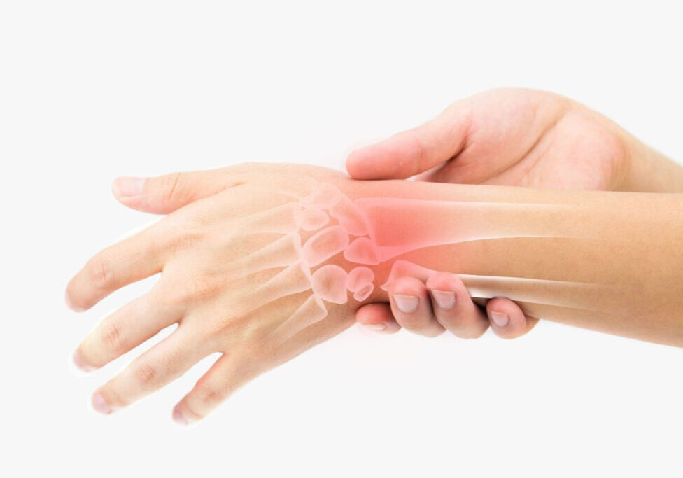 Arthritis, Hand